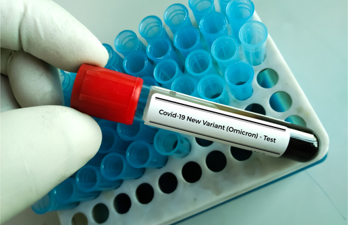 A Shortage of Covid-19 Tests in Europe and the U.S.A. Is Disrupting International Travel | Frommer's