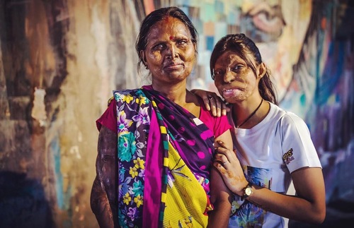 Near the Taj Mahal, A Cafe by Acid Attack Survivors That Shares Beauty with Tourists | Frommer's